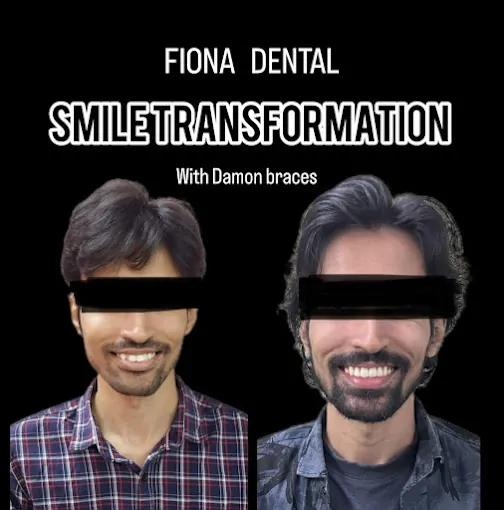 Image of: Fiona Dental Clinic In Teynampet