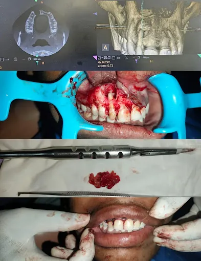 Image of: Fiona Dental Clinic In Teynampet 2