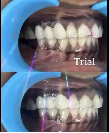 Image of: Fiona Dental Clinic In Teynampet 3