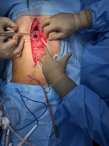 Image of: Gastro Care Clinic In Teynampet 3