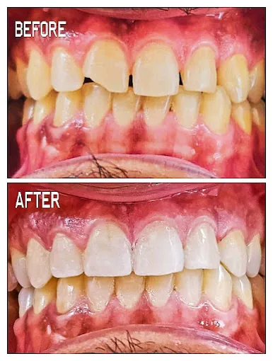 Image of: Hemarun Dental Clinic And Lab In Perambur