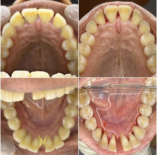 Image of: Impressions Dental Cosmetic And Hair In Mylapore