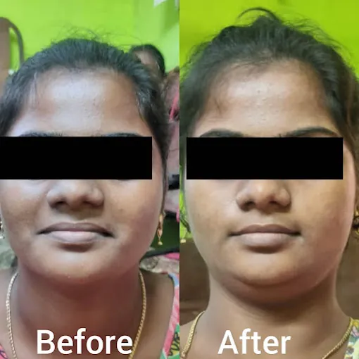 Image of: Indiras Lifecare Clinic In Tondiarpet 6