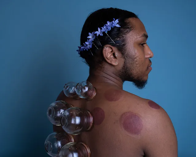 Image of: Jaas Acupuncture And Hijama Clinic In Kodungaiyur 3