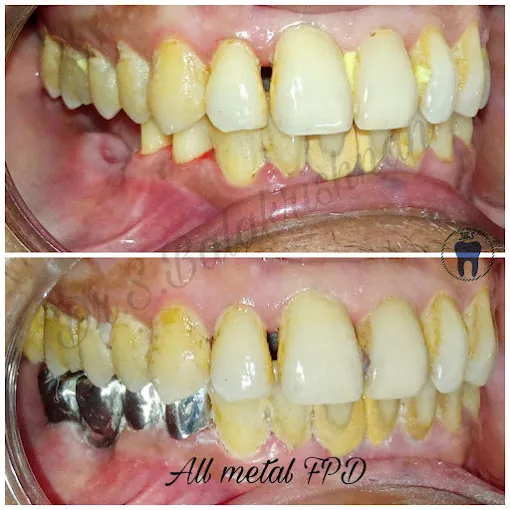 Image of: Jbs Dental Clinic In Triplicane 2