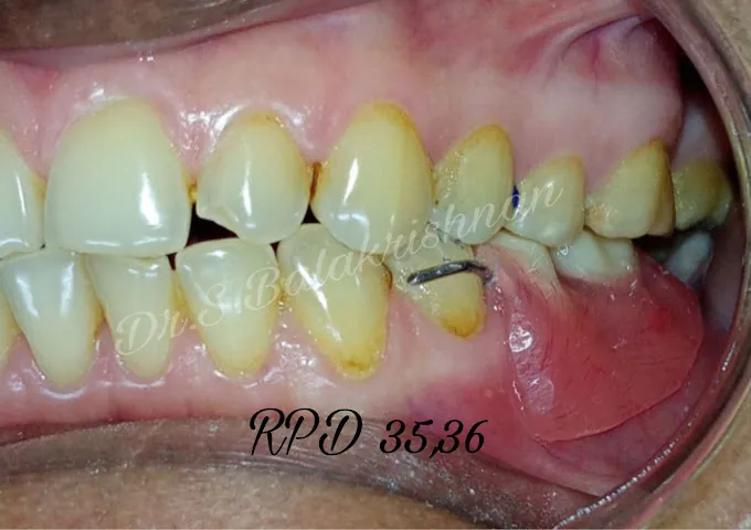 Image of: Jbs Dental Clinic In Triplicane 3