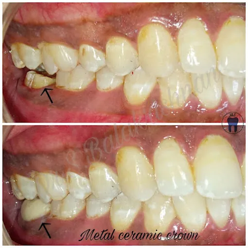 Image of: Jbs Dental Clinic In Triplicane 4