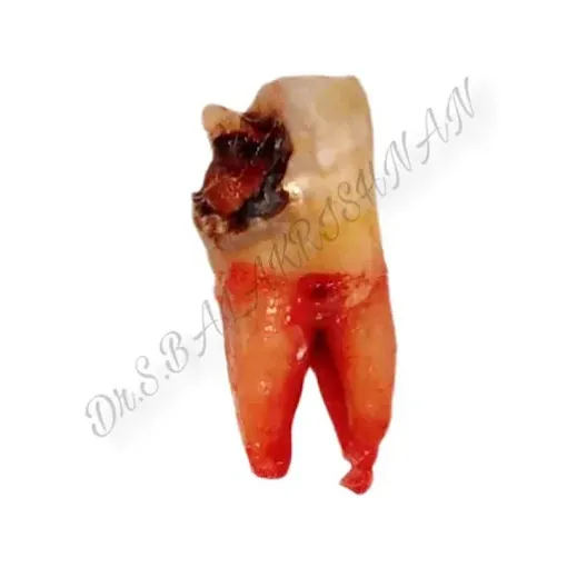Image of: Jbs Dental Clinic In Triplicane 6