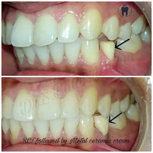 Image of: Jbs Dental Clinic In Triplicane 7