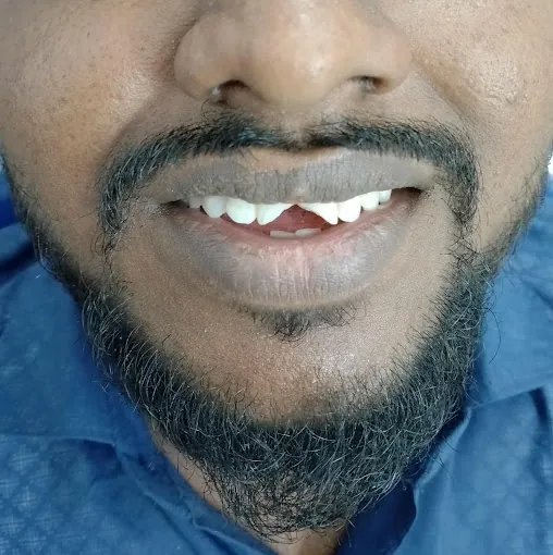 Image of: Jovani Dental Clinic Dental Clinic In Thiruvanmiyur