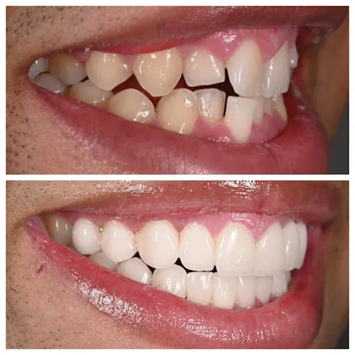 Image of: Malligai Dental Hospital In Mambalam