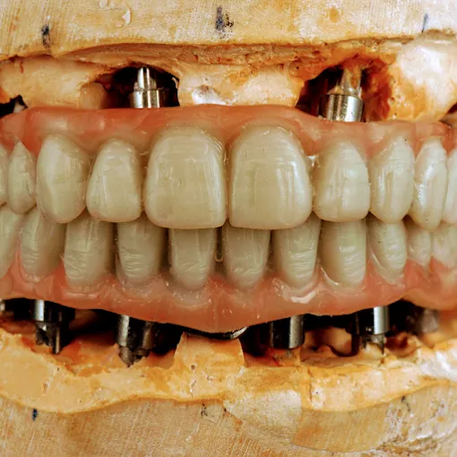 Image of: Malligai Dental Hospital In Mambalam 3