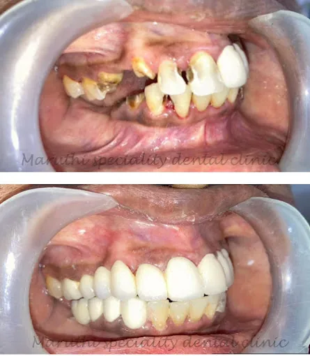 Image of: Maruthi Specality Dental Clinic In Saidapet 2