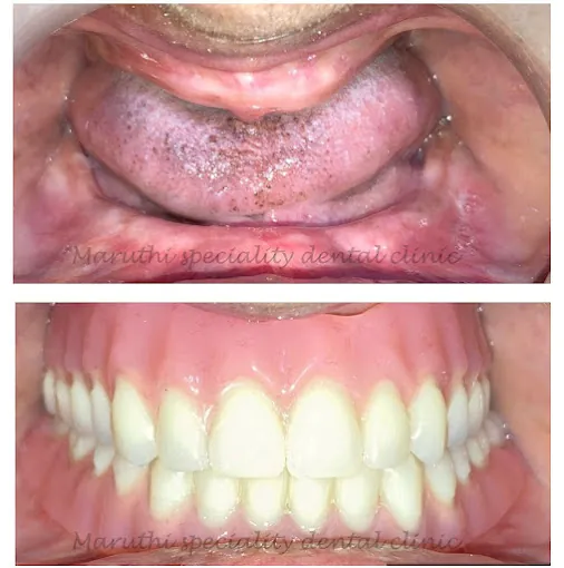 Image of: Maruthi Specality Dental Clinic In Saidapet