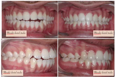 Image of: Merakii Dental Studio In Chetpet