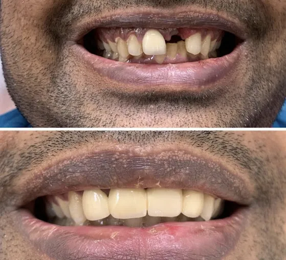 Image of: Metro Dental Care In Saidapet