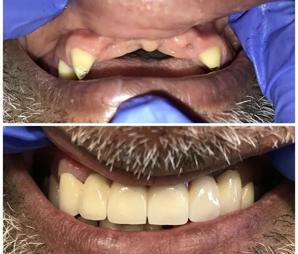 Image of: Metro Dental Care In Saidapet 3