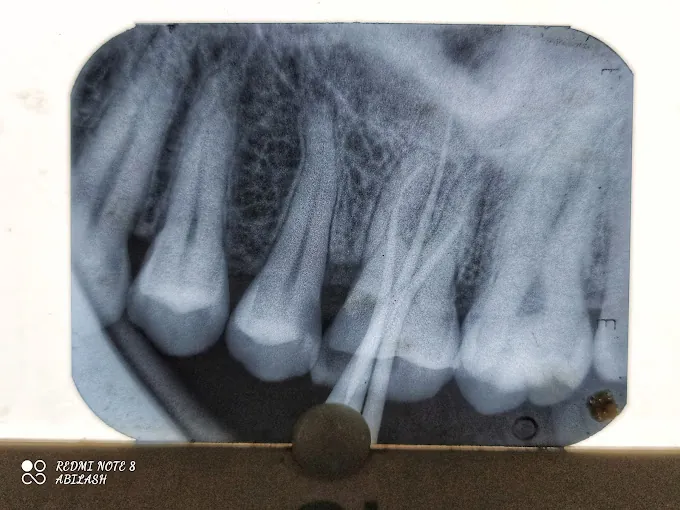 Image of: Mj Dental Clinic And Implant In Chennai