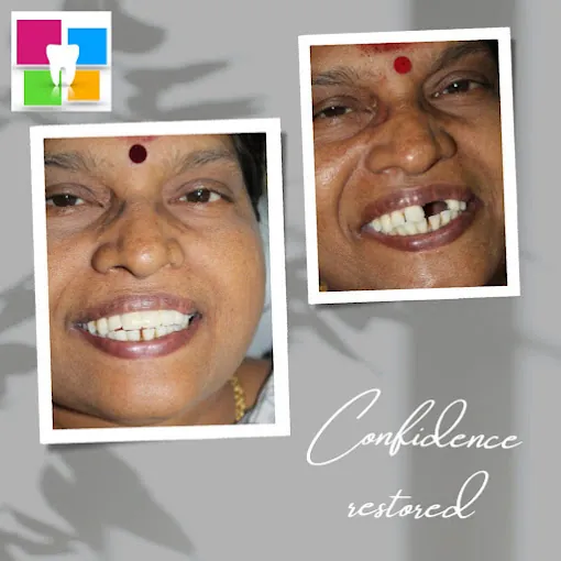 Image of: Mohammed Dental Care Implant Centre In Ayanavaram 3