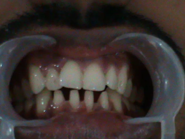 Image of: Moscow Dental Clinic In Perambur