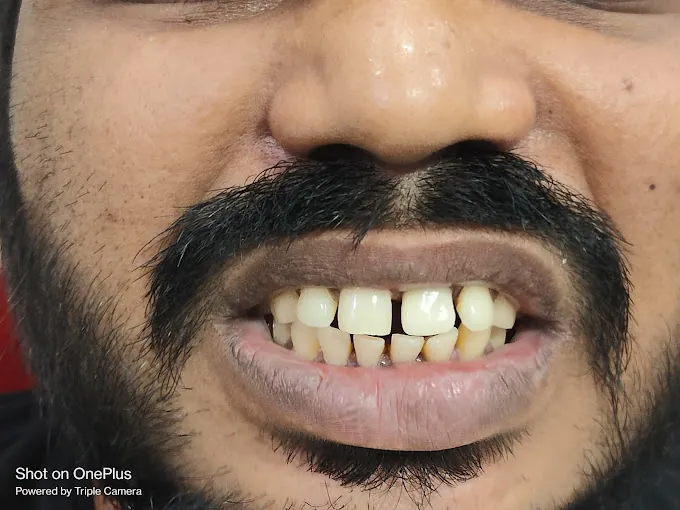 Image of: Moscow Dental Clinic In Perambur 2