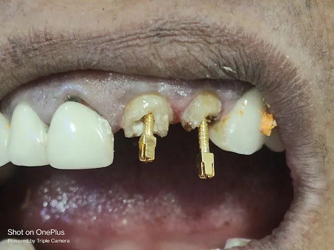 Image of: Moscow Dental Clinic In Perambur 3