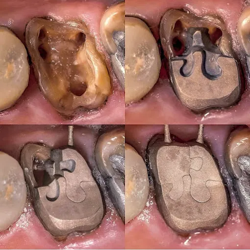 Image of: Moscow Dental Clinic In Perambur