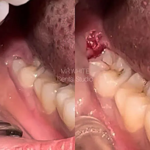 Image of: Mr White Dental Studio In Saidapet