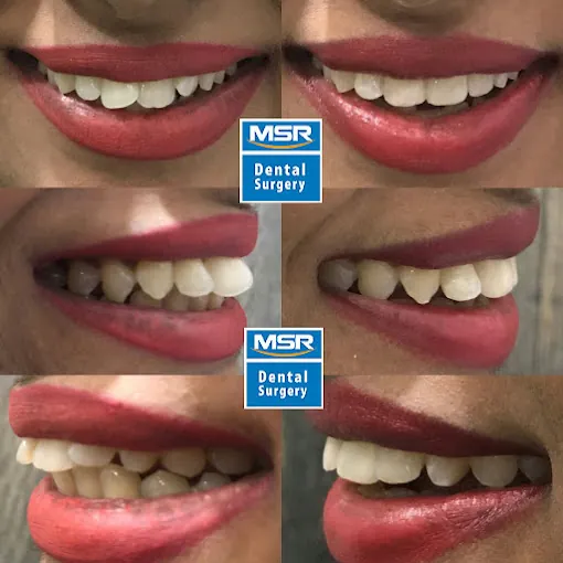 Image of: Msr Dental In T Nagar 6