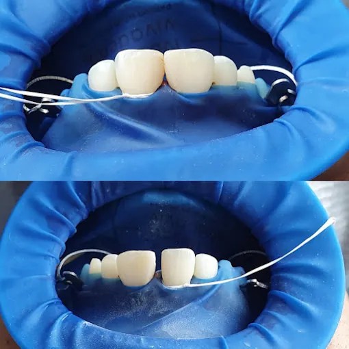 Image of: My Dental Specialist In Saligramam 2