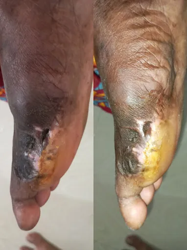 Image of: Mz Medcare Clinic And Nxgen In Villivakkam 3