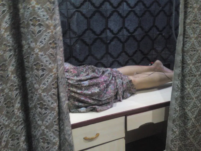 Image of: Nazirs Acuheal Acupuncture And Cupping In Arumbakkam 6