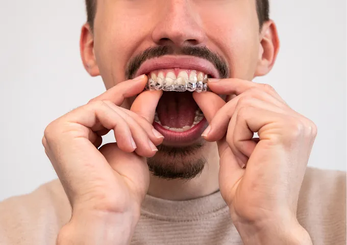Image of: Oasis Dental Care In Arumbakkam