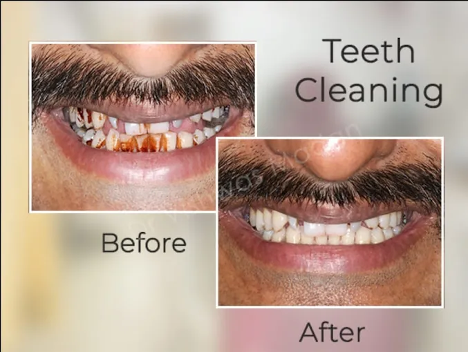 Image of: Olive Dental Clinic In Mylapore 3