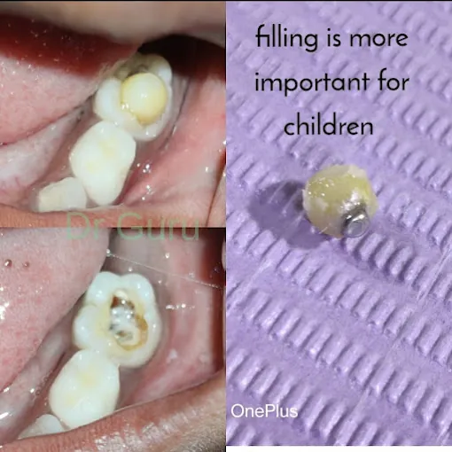 Image of: Olive Dental Clinic In Mylapore