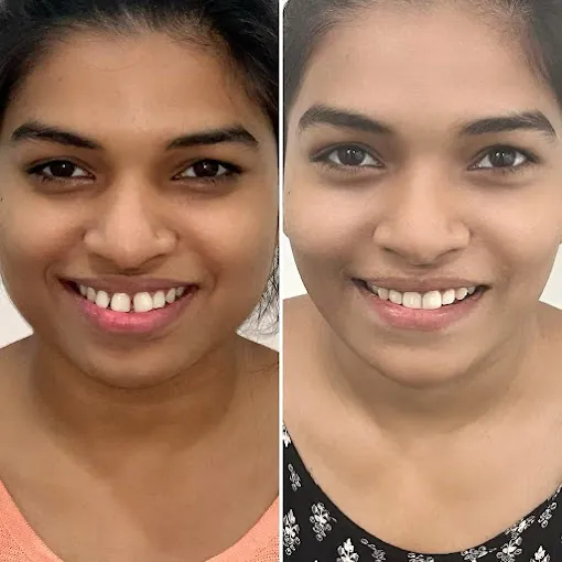 Image of: Orthosquare Dental Clinic In Velachery