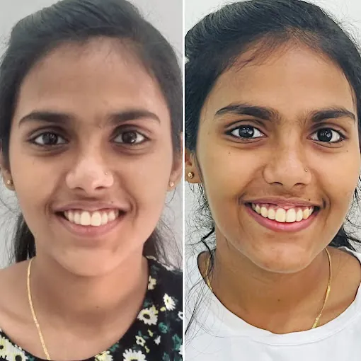 Image of: Orthosquare Dental Clinic In Velachery 3