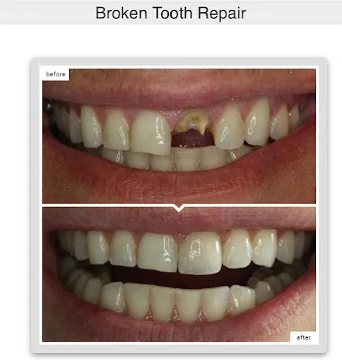 Image of: Parshva Dental Centre In Sowcarpet
