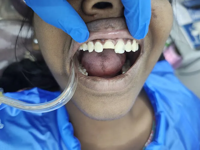 Image of: Pixie Dental Care In Nungambakkam 3