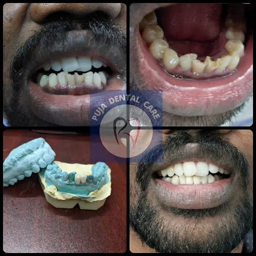 Image of: Puja Dental Care In Saidapet 3