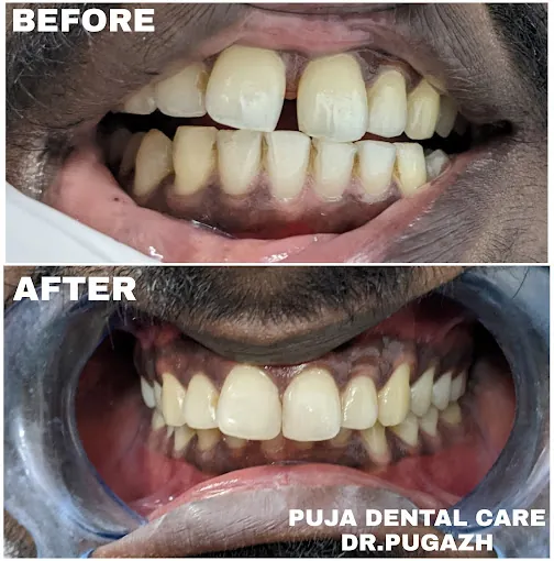 Image of: Puja Dental Care In Saidapet 4