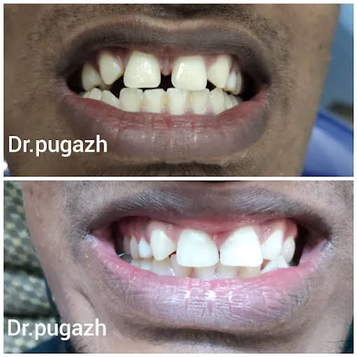 Image of: Puja Dental Care In Saidapet 5