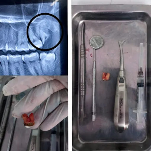 Image of: Puja Dental Care In Saidapet 7