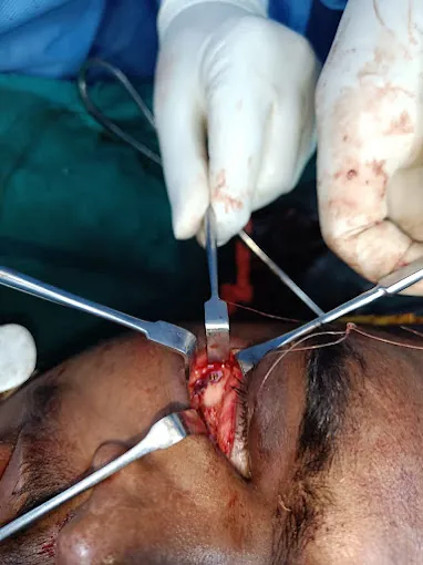 Image of: Pulp Dental Hospital In Nungambakkam