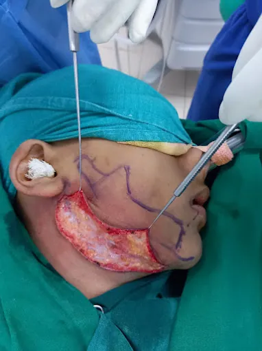 Image of: Pulp Dental Hospital In Nungambakkam 2