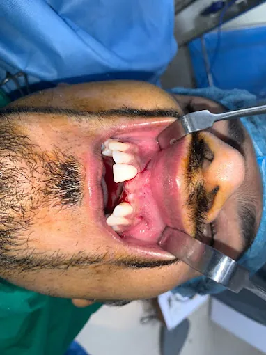 Image of: Pulp Dental Hospital In Nungambakkam 5