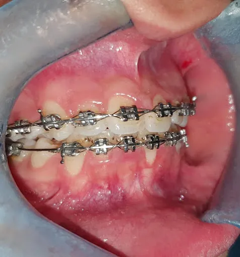 Image of: Pulp Dental Hospital In Nungambakkam 6