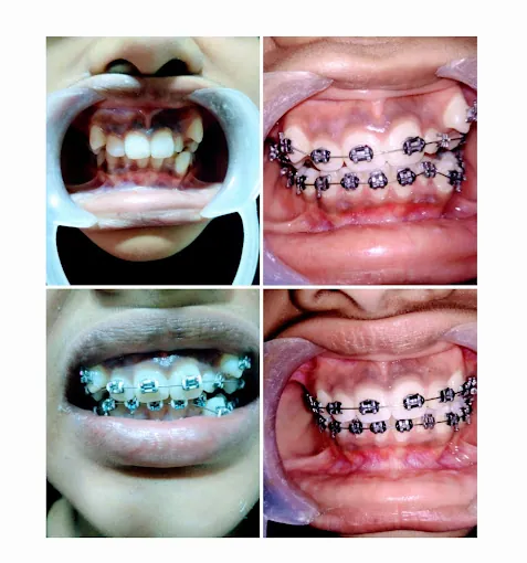 Image of: Rayyaan Dental Care In Triplicane 2