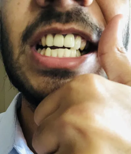 Image of: Rayyaan Dental Care In Triplicane 3