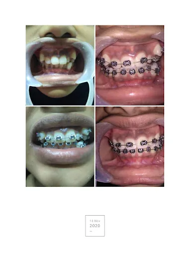 Image of: Rayyaan Dental Care In Triplicane 4